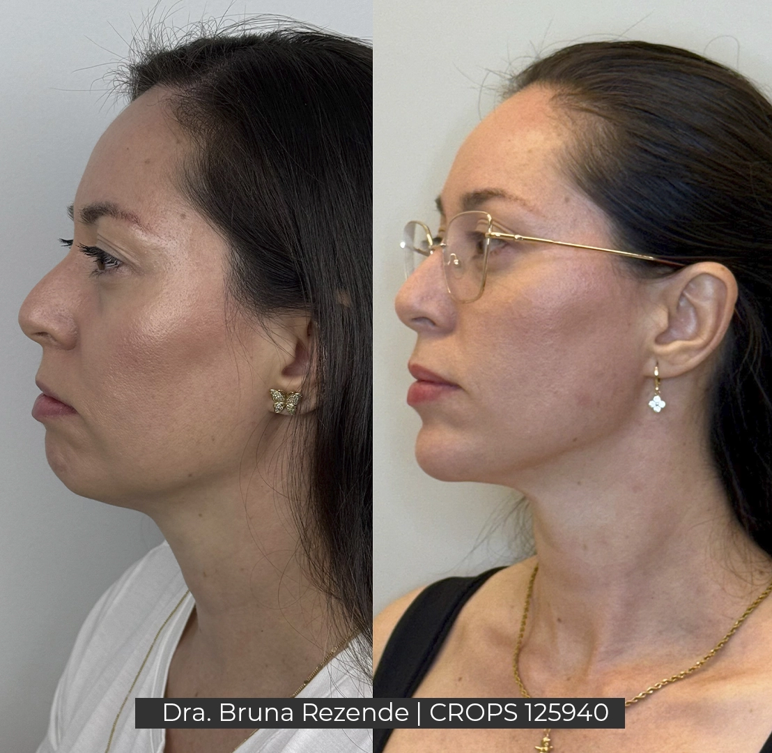 Antes e Depois 1