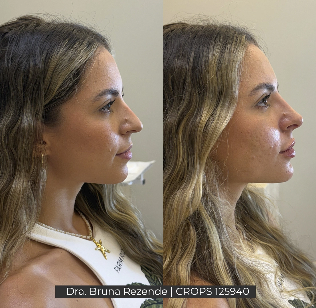 Antes e Depois 3