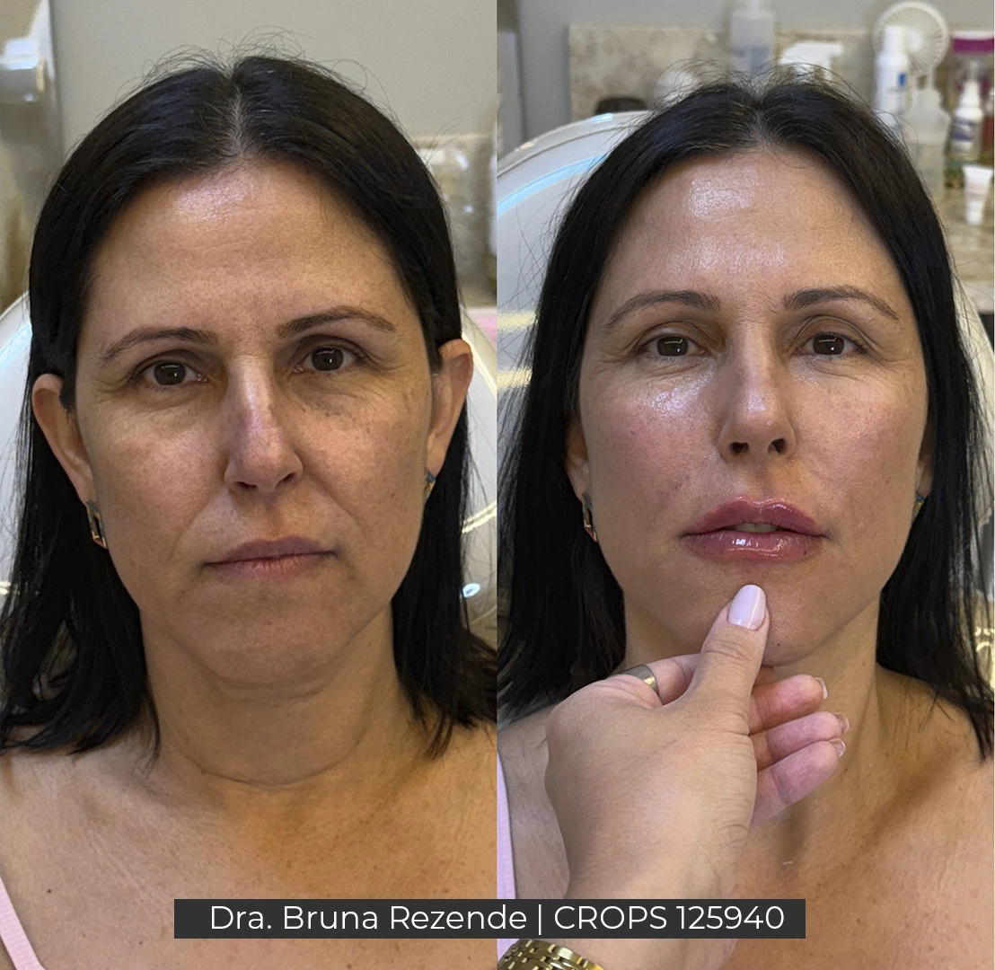 Antes e Depois 6