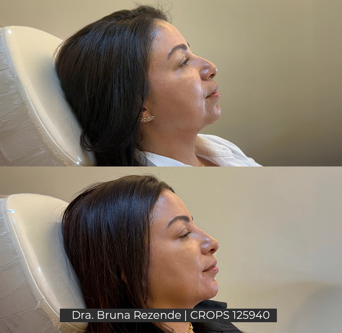 Antes e Depois 10