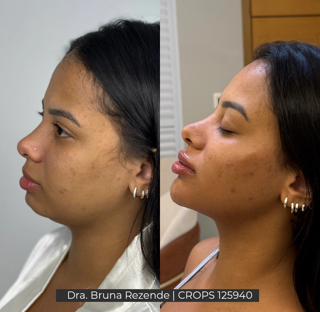 Antes e Depois 9